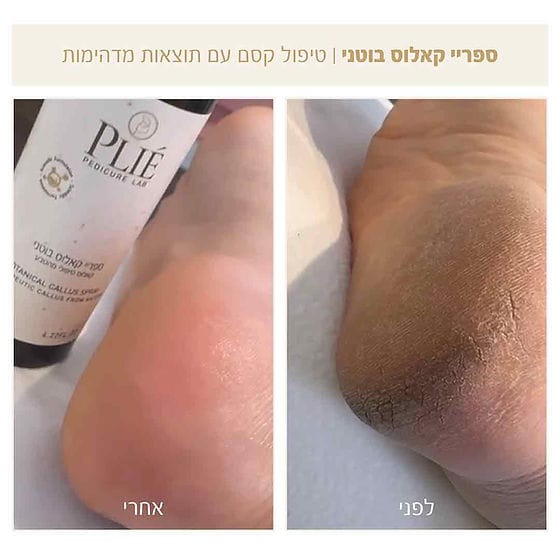 ספריי קאלוס בוטני לרגליים 125 מ"ל-פליאה Plie